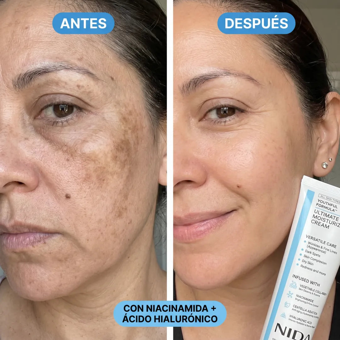 Crema Nida Upsell