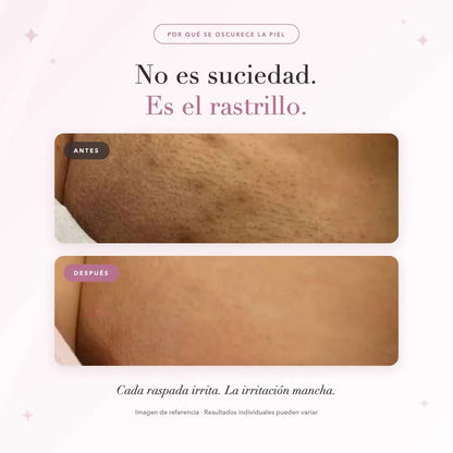 Depiladora Mujer Con Doble Cabezal